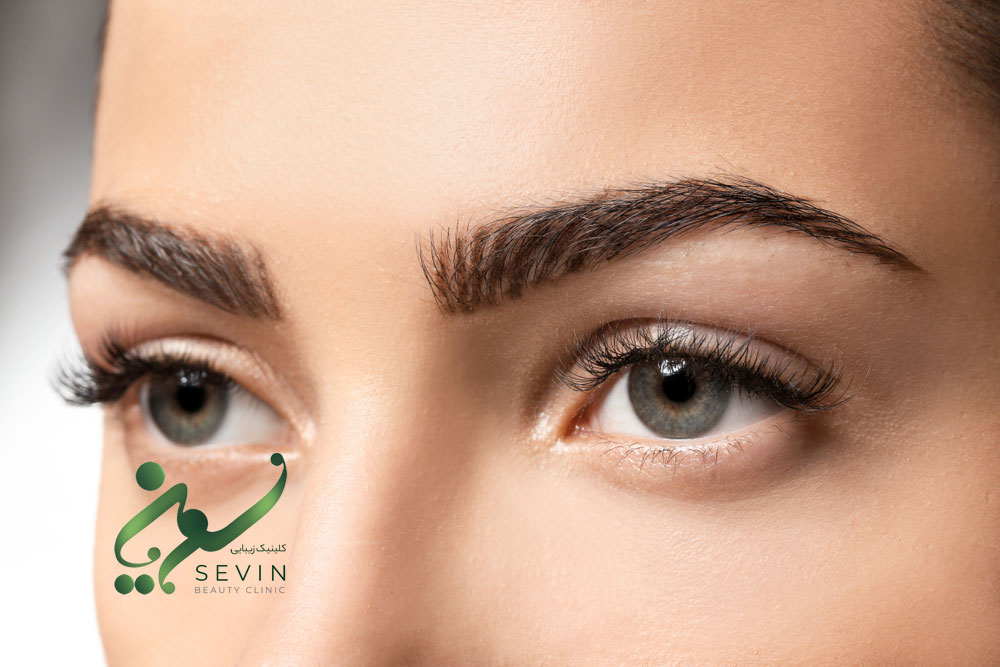 eyebrows eyebrow transplant